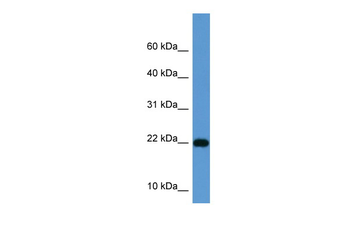 ISG15 Rabbit Polyclonal Antibody