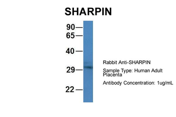 SHARPIN Rabbit Polyclonal Antibody