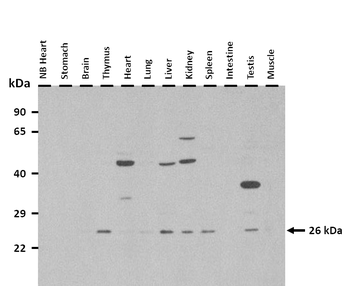 Scamp5 Rabbit Polyclonal Antibody