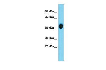Sstr1 Rabbit Polyclonal Antibody