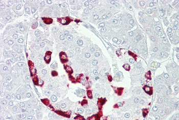 SSTR1 Rabbit Polyclonal Antibody