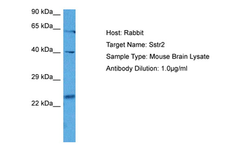 SSTR2 Rabbit Polyclonal Antibody
