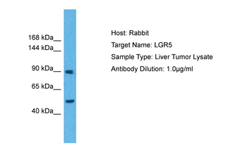LGR5 Rabbit Polyclonal Antibody