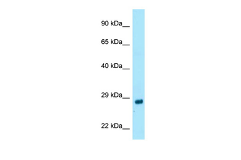 RAB4A Rabbit Polyclonal Antibody