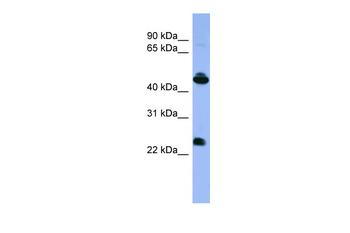OPN1MW Rabbit Polyclonal Antibody