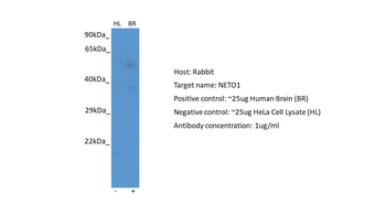 NETO1 Rabbit Polyclonal Antibody