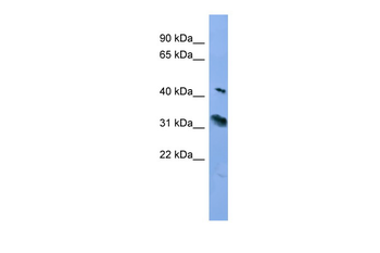 RHO Rabbit Polyclonal Antibody