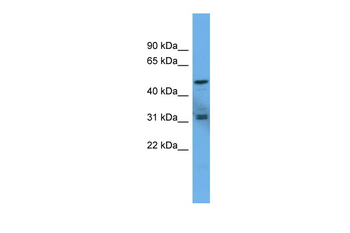 ADCYAP1R1 Rabbit Polyclonal Antibody