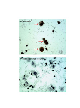 ADORA2A Rabbit Polyclonal Antibody