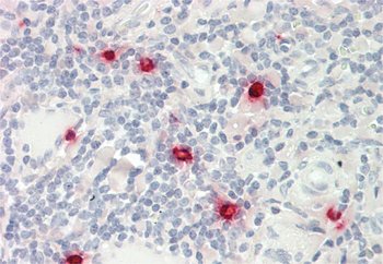 CMA1 Rabbit Polyclonal Antibody