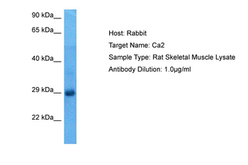 CA2 Rabbit Polyclonal Antibody
