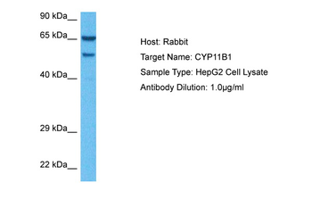 CYP11B1 Rabbit Polyclonal Antibody