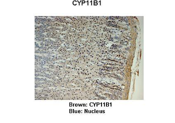 CYP11B1 Rabbit Polyclonal Antibody