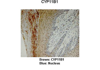 CYP11B1 Rabbit Polyclonal Antibody