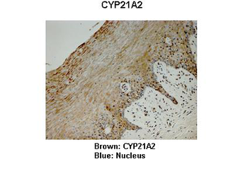 CYP21A2 Rabbit Polyclonal Antibody