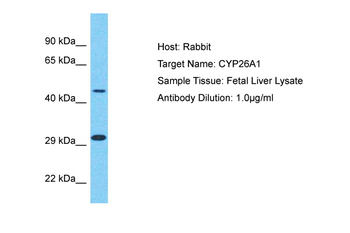 CYP26A1 Rabbit Polyclonal Antibody