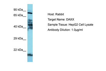 DAXX Rabbit Polyclonal Antibody