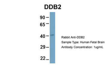 DDB2 Rabbit Polyclonal Antibody