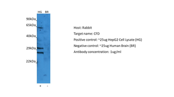 CFD Rabbit Polyclonal Antibody
