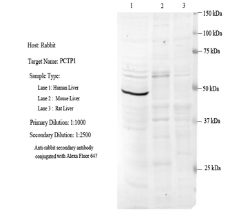 ASNS Rabbit Polyclonal Antibody