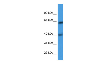 ARPM1 Rabbit Polyclonal Antibody