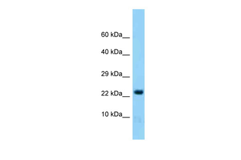 Hint2 Rabbit Polyclonal Antibody