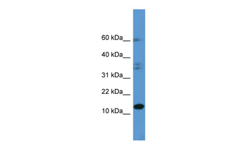 HINT2 Rabbit Polyclonal Antibody