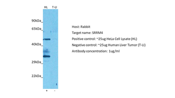 SRRM4 Rabbit Polyclonal Antibody