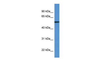 TUBB6 Rabbit Polyclonal Antibody