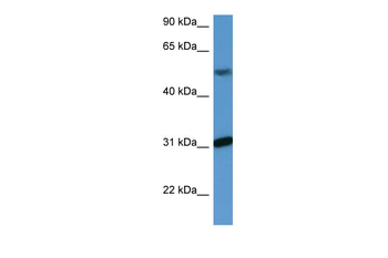 WDR83 Rabbit Polyclonal Antibody