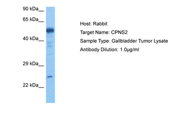 CAPNS2 Rabbit Polyclonal Antibody