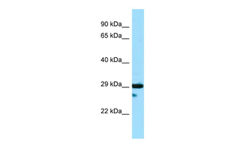 DTNBP1 Rabbit Polyclonal Antibody