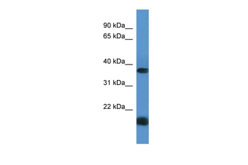 RHBDD1 Rabbit Polyclonal Antibody