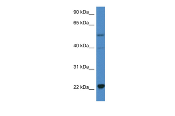 IL18 Rabbit Polyclonal Antibody
