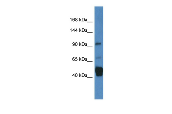 JAKMIP2 Rabbit Polyclonal Antibody