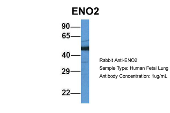 ENO2 Rabbit Polyclonal Antibody