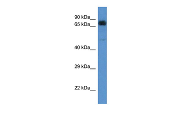 ACAD9 Rabbit Polyclonal Antibody