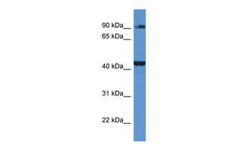 AMACR Rabbit Polyclonal Antibody