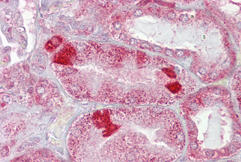 AMACR Rabbit Polyclonal Antibody