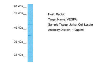 VEGFA Rabbit Polyclonal Antibody