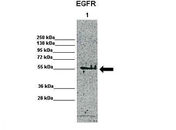 EGFR Rabbit Polyclonal Antibody