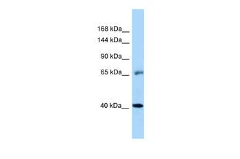 EGFR Rabbit Polyclonal Antibody