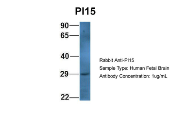 PI15 Rabbit Polyclonal Antibody