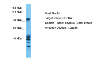 PDGFRA Rabbit Polyclonal Antibody