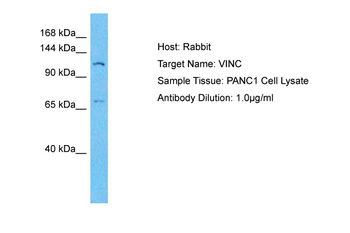 VCL Rabbit Polyclonal Antibody