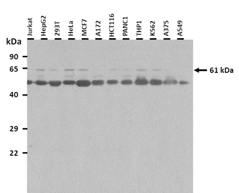 HEXA Rabbit Polyclonal Antibody
