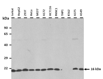 SOD1 Rabbit Polyclonal Antibody