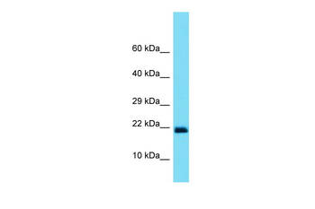 SOD1 Rabbit Polyclonal Antibody