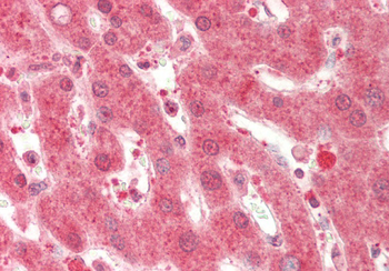 GC Rabbit Polyclonal Antibody