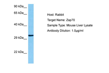 ZAP70 Rabbit Polyclonal Antibody